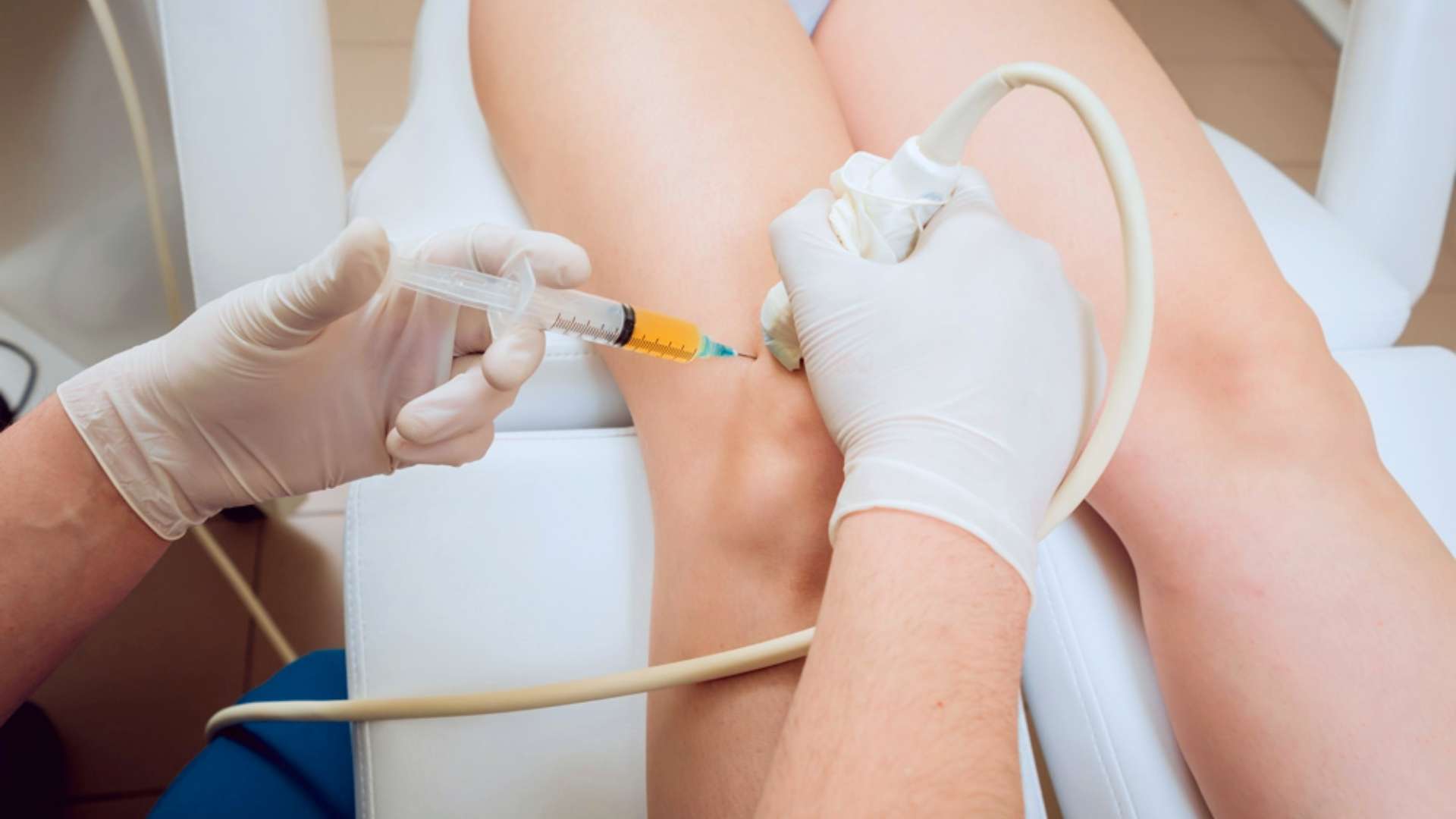 PRP Articular (Rodilla, Hombro, Cadera)